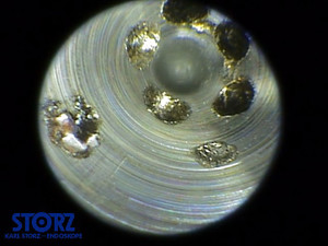 Borescope view of injecotr nozzle.
